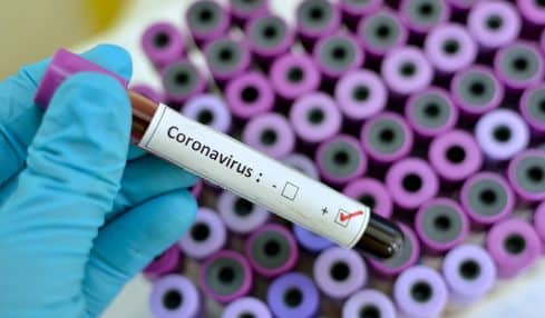 Coronavirus positiv Patient