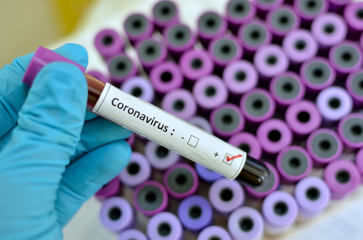 Coronavirus positiv Patient